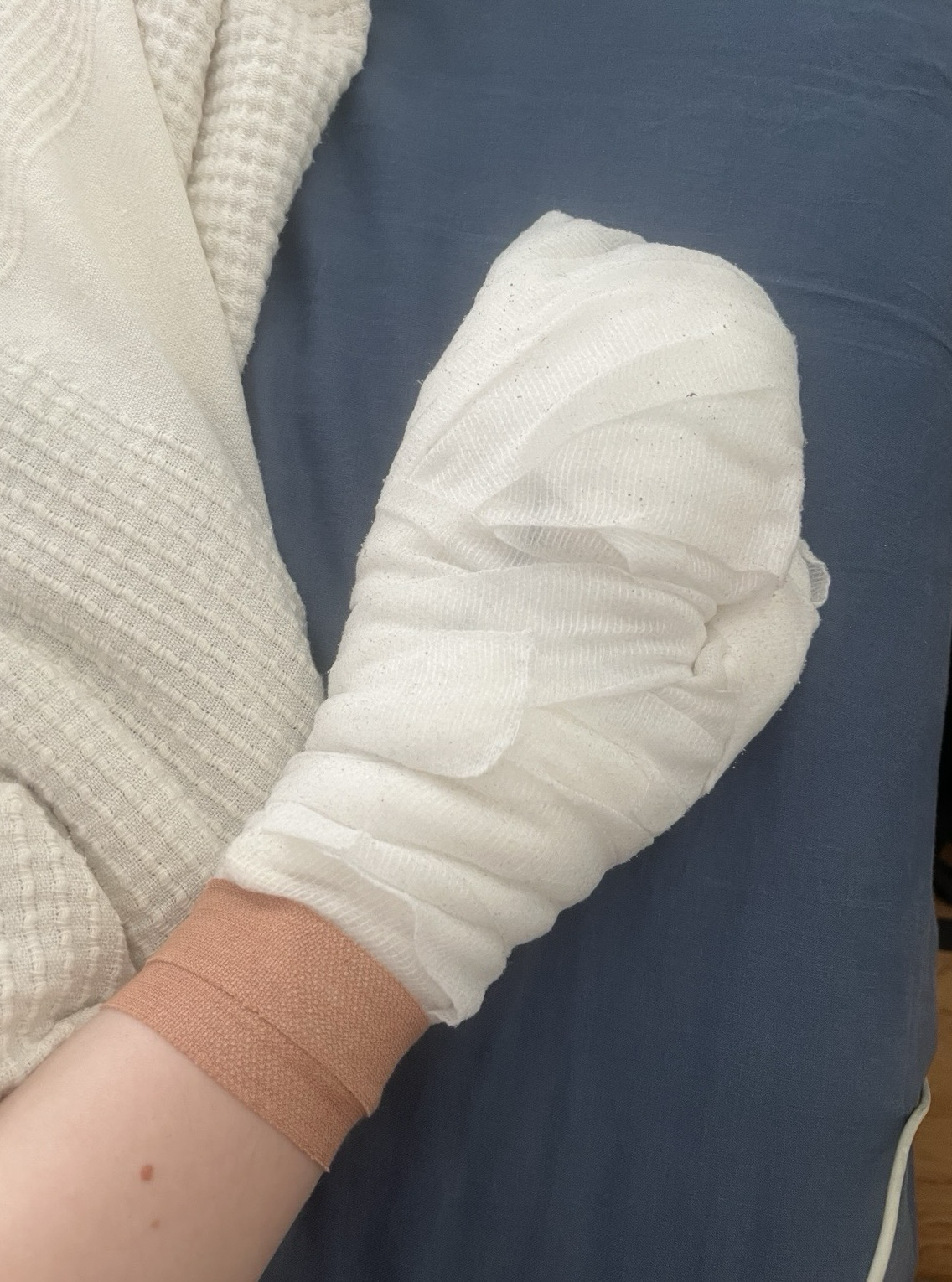 A picture of a left hand all in bandages.